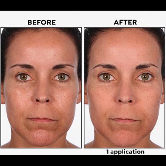 Skinn Cosmetics Non-Negotiables DermAppeal Jumbo 4 Oz. Tube, New Sealed - Picture 6 of 10